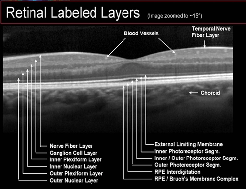 Retinal layers labeled on OCT scan