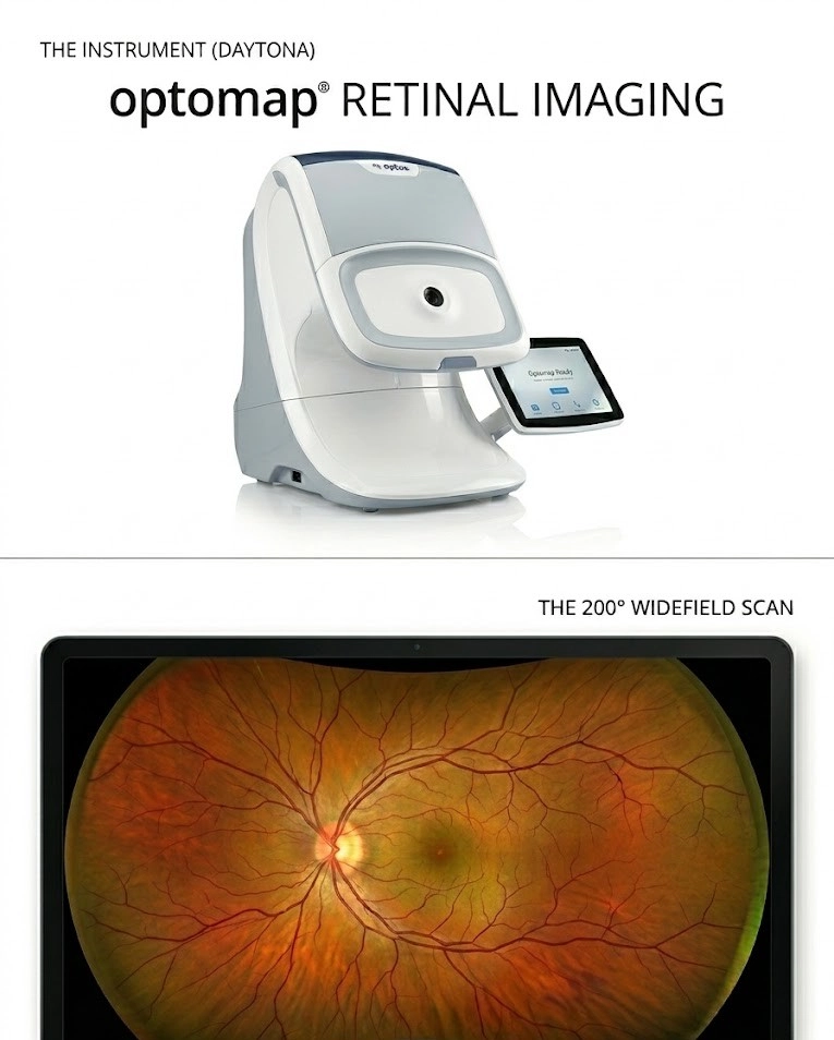 Optos OPTOMAP retinal imaging machine